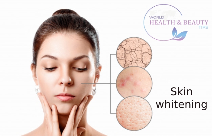 Skin whitening